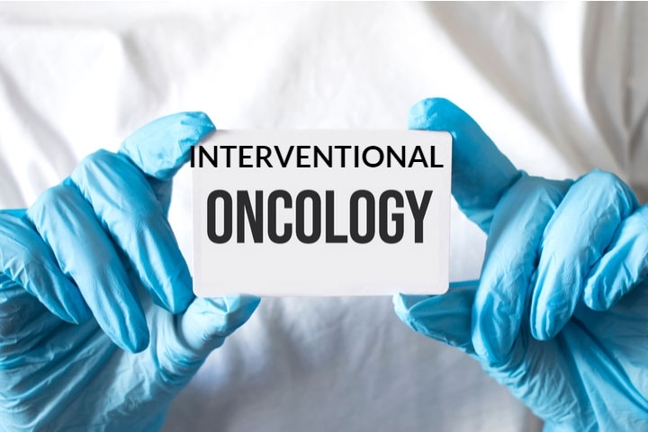 Interventional Oncology Oncologists Dream Technique