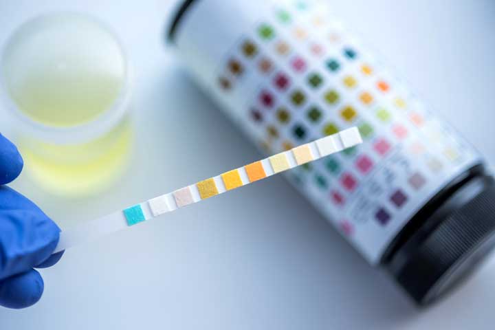 How Digital Technology is Changing the Landscape of Urinalysis